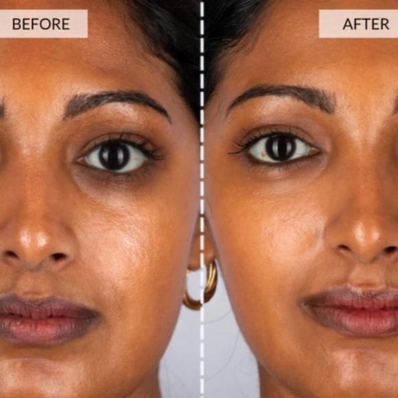 CurrentBody Skin LED Light Therapy Face Mask The world’s most powerful anti-agin - Picture 7 of 16